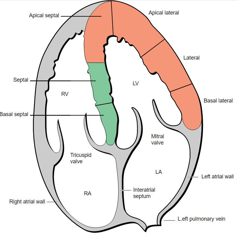 Lynch - Drawing Apical four-chamber diagram of heart - English labels